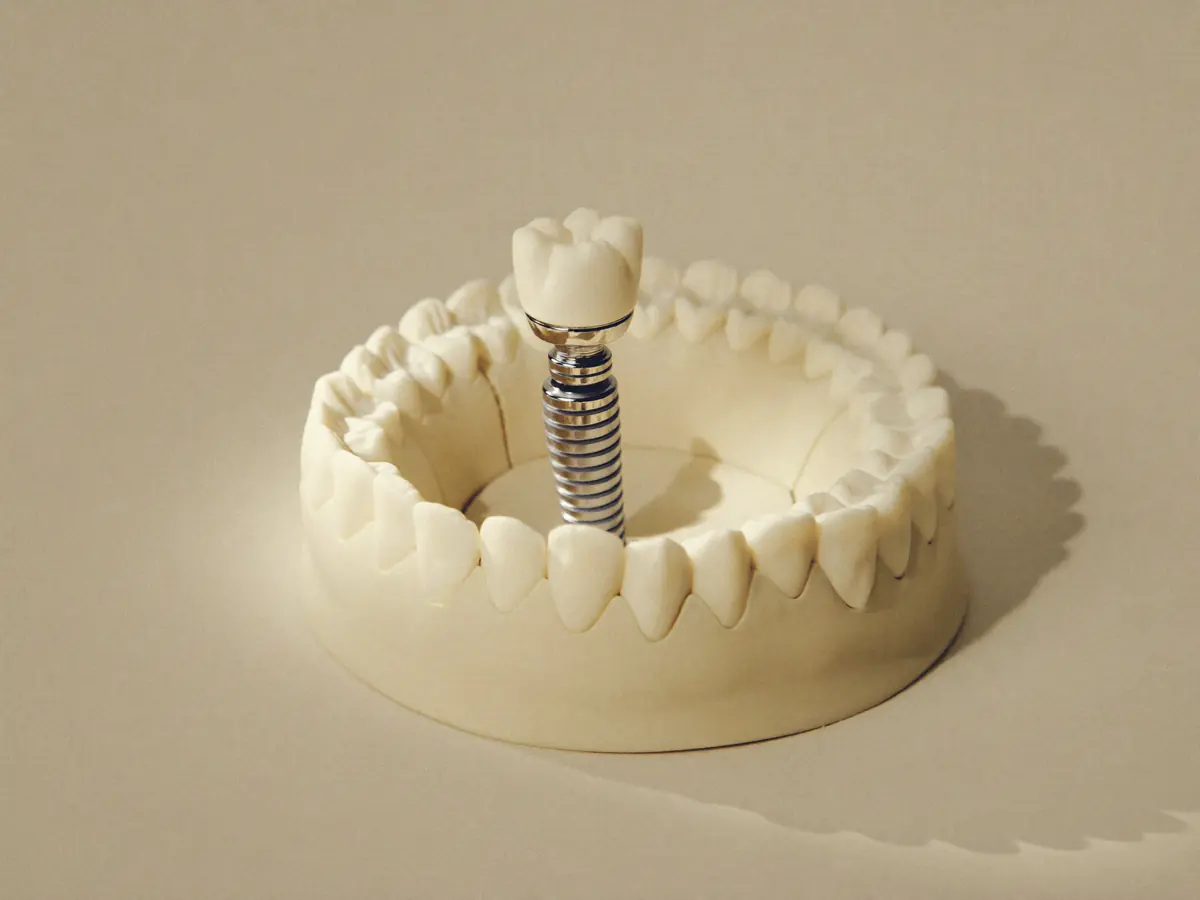 Implantologija — Dental Milošević